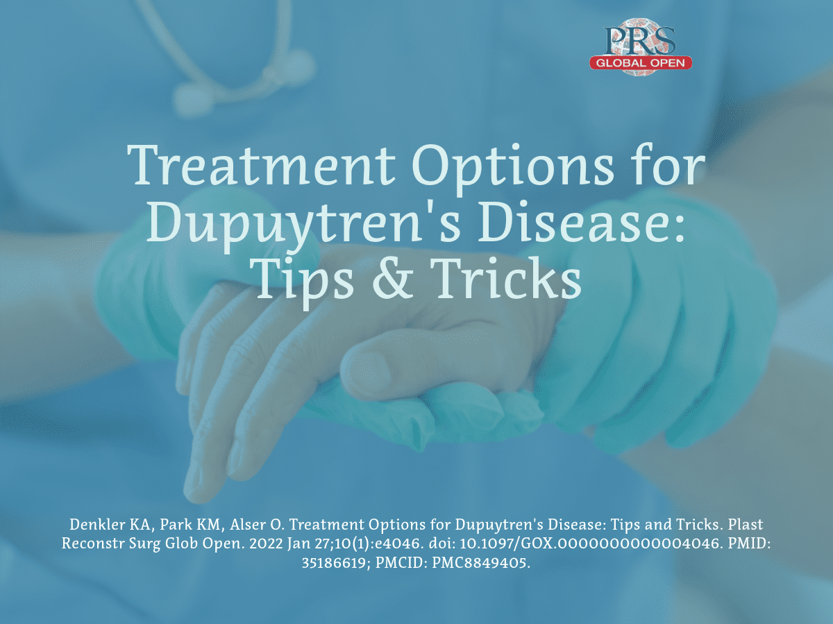 Treatment Options for Dupuytren's Disease